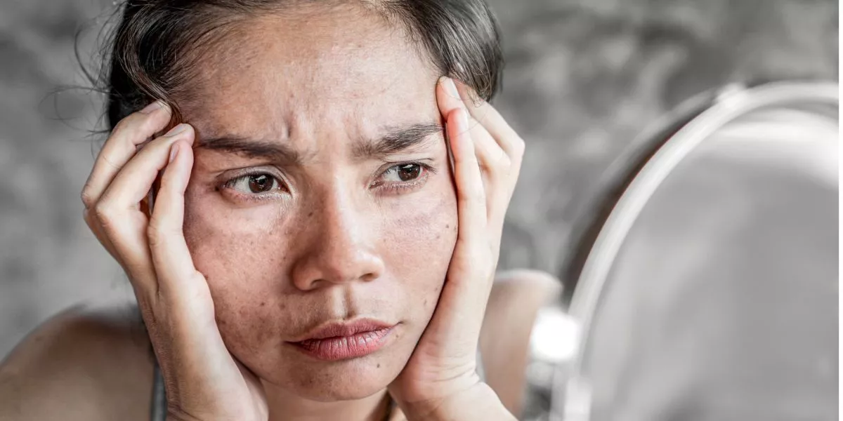 Can Makeup Cause Skin Problems, and How Can I Prevent Them? Can Makeup Cause Skin Problems, and How Can I Prevent Them?